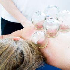 TCM Cupping Therapie